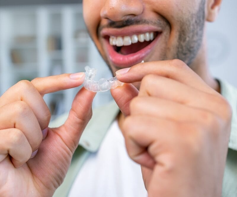 Close-up Of A Man's Hand Putting Transparent Aligner In Teeth