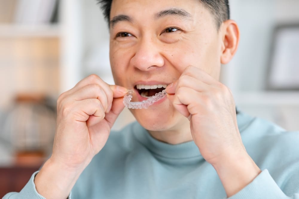 A man is placing a clear dental aligner over his teeth - Dentist Atlanta