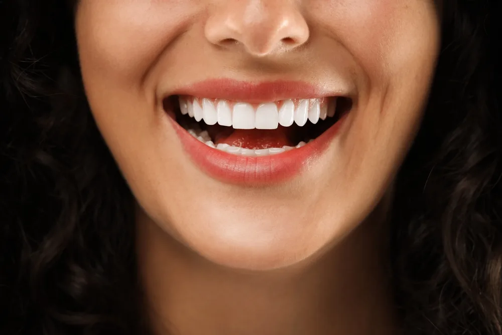 Close-Up of a Smooth, White, Confident Smile – Cosmetic Dentistry Buckhead GA A close-up of a woman's radiant white teeth as she smiles, highlighting the results of expert cosmetic dental care – Cosmetic Dentistry Buckhead GA.