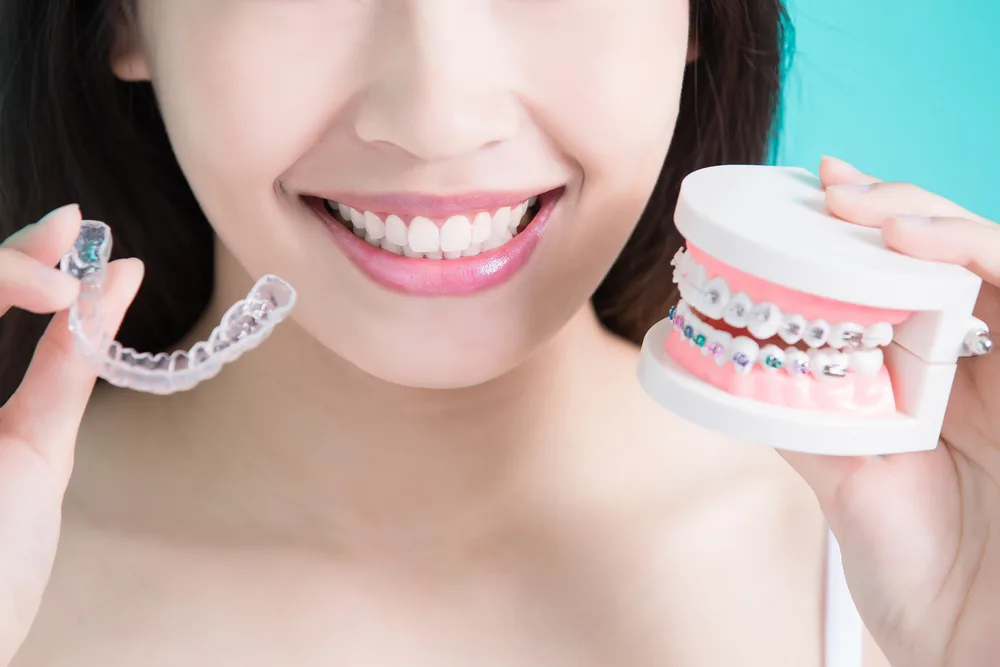 Clear Aligners vs Braces for a Beautiful Smile – Cosmetic Dentistry Buckhead GA A smiling woman holds a clear aligner in one hand and a braces model in the other, showing modern orthodontic options for achieving a straighter smile – Cosmetic Dentistry Buckhead GA.